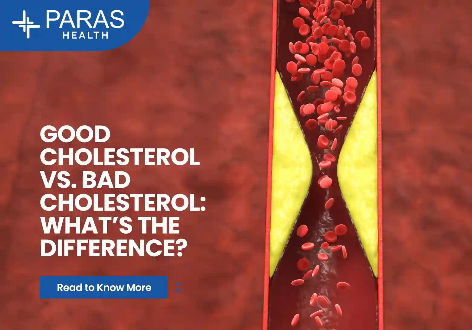 Good Cholesterol vs Bad Cholesterol – Difference, Normal Levels & Ways to Control